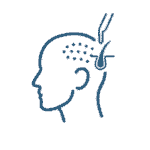 Icono Trasplante-Capilar-por-el-Dr-Couto-en-FUExpert-Clinic-clinica-capilar-en-Madrid-Espana